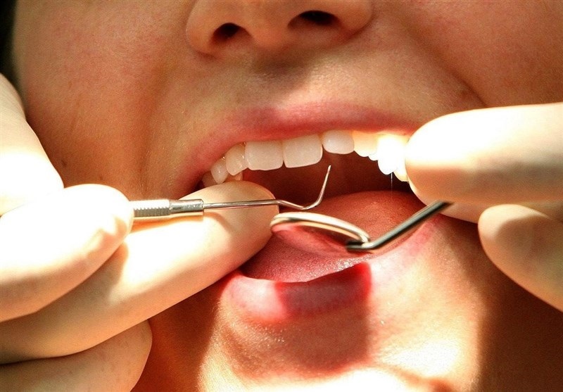 ارائه بیش از ۱۵۰۰ خدمت تشخیصی و درمانی دندانپزشکی در البرز